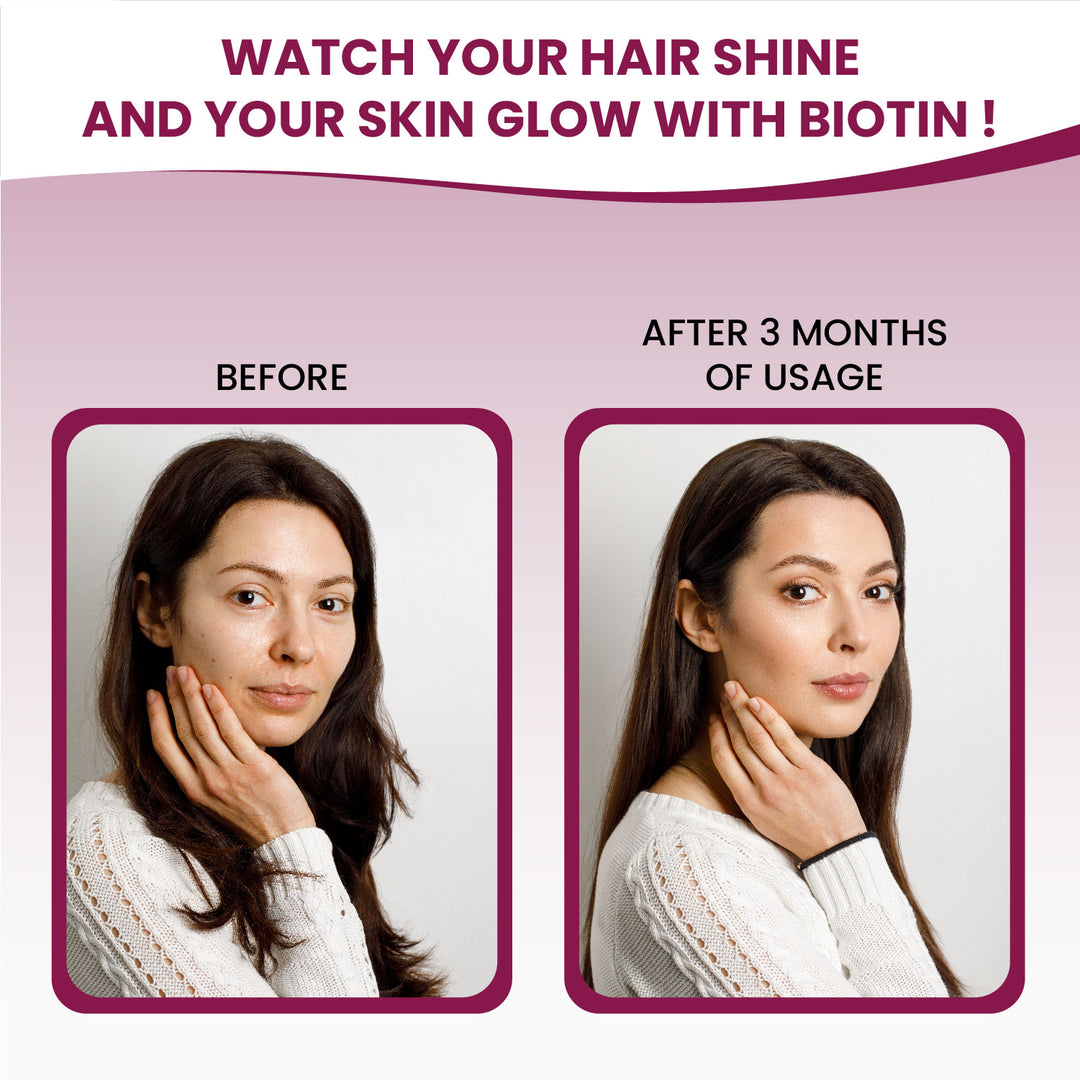 Vlado’s Himalayan Organics Biotin 10000 MCG tablets for Hair Growth, Radiant Skin and Stronger Nails I Sesbania Grandiflora Extract Biotin I Biotin Supplement for men & Women - 90 Veg Tablets