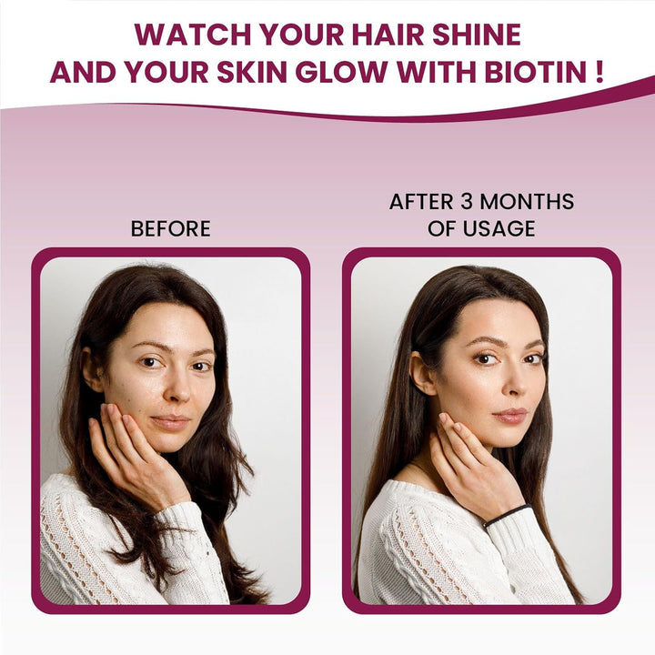 Vlado’s Himalayan Organics Biotin 10000mcg Supplement for Hair Growth, Strong Hair and Glowing Skin, Nail I Sesbania Extract Biotin tablets For Men & Women - 60 Veg Tablets
