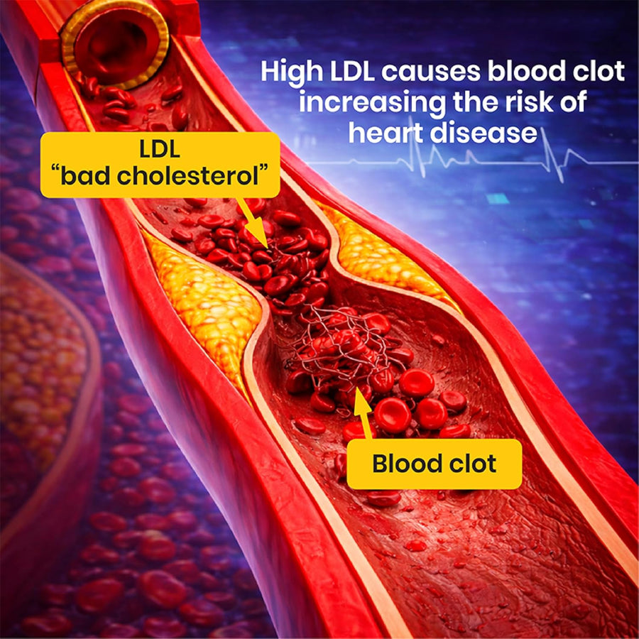 Cholestrol Control Formula - Reduces LDL and Triglycerides Supplement